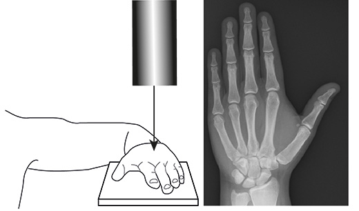 Рентген кисти на горизонтальной поверхности Рентген кисти на горизонтальной поверхности