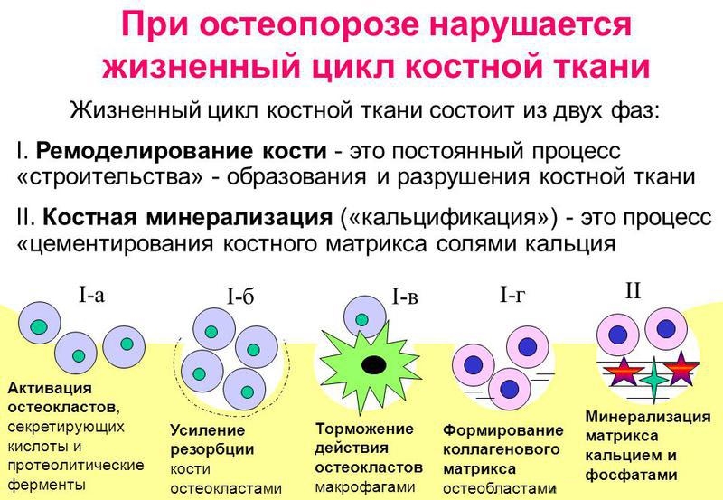Резорбция костной ткани Резорбция костной ткани