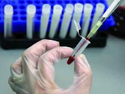 Сбор анализов Сбор анализов