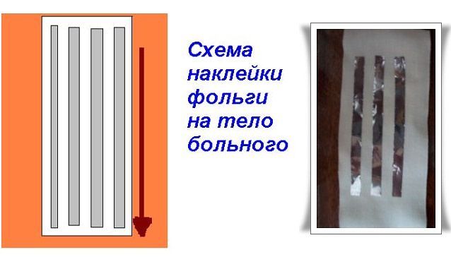 Серебряный мостик Серебряный мостик