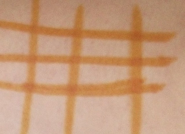 Сетка йодом