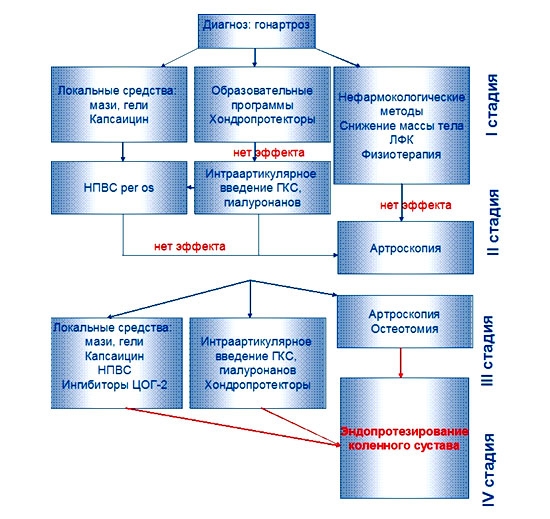 Схема лечения артроза Схема лечения артроза