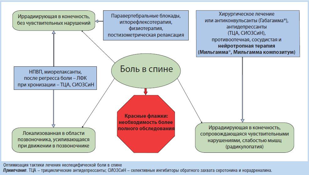 Схема лечения радикулопатии Схема лечения радикулопатии