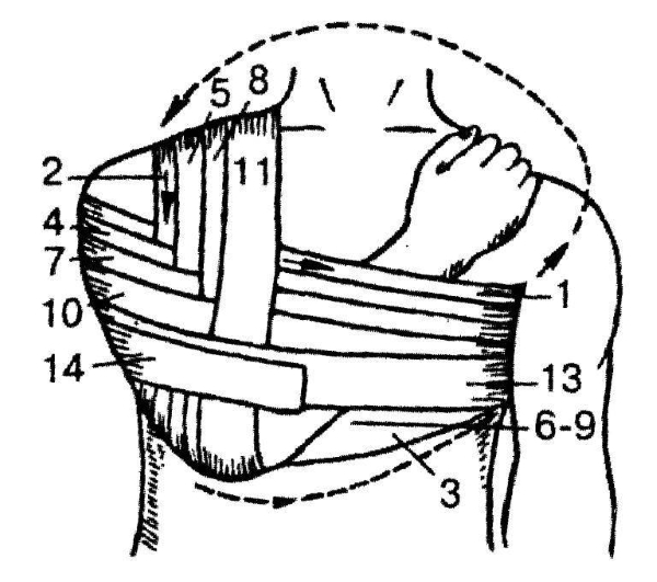Схема повязки Вельпо Схема повязки Вельпо