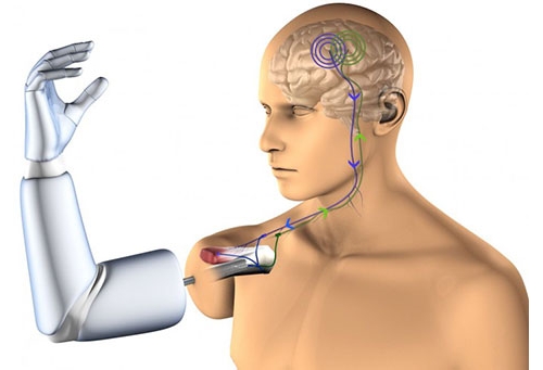 Действие бионического протеза Действие бионического протеза