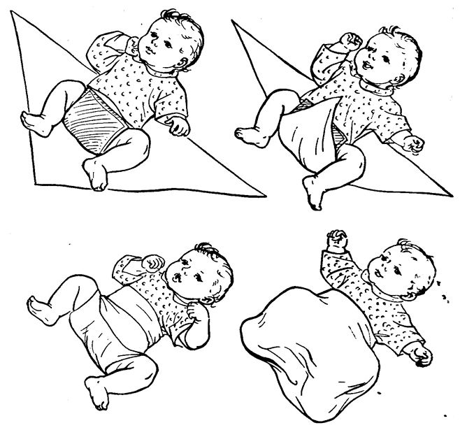 Широкое пеленание Широкое пеленание