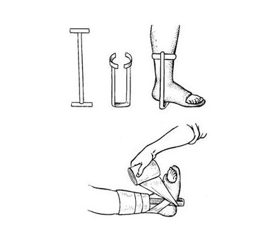 Наложение шины при переломе стопы Наложение шины при переломе стопы