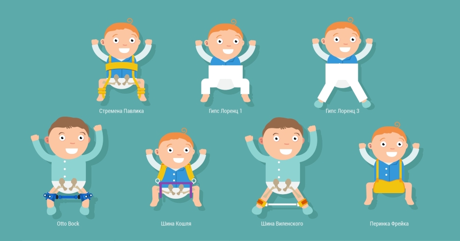 Шины при дисплазии тазобедренного сустава Шины при дисплазии тазобедренного сустава