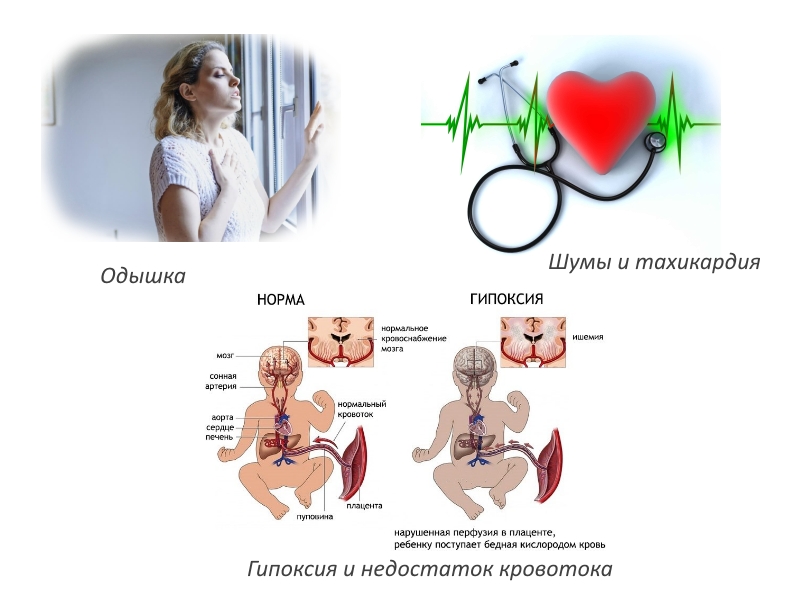 Опасные симптомы артрита при беременности Опасные симптомы артрита при беременности