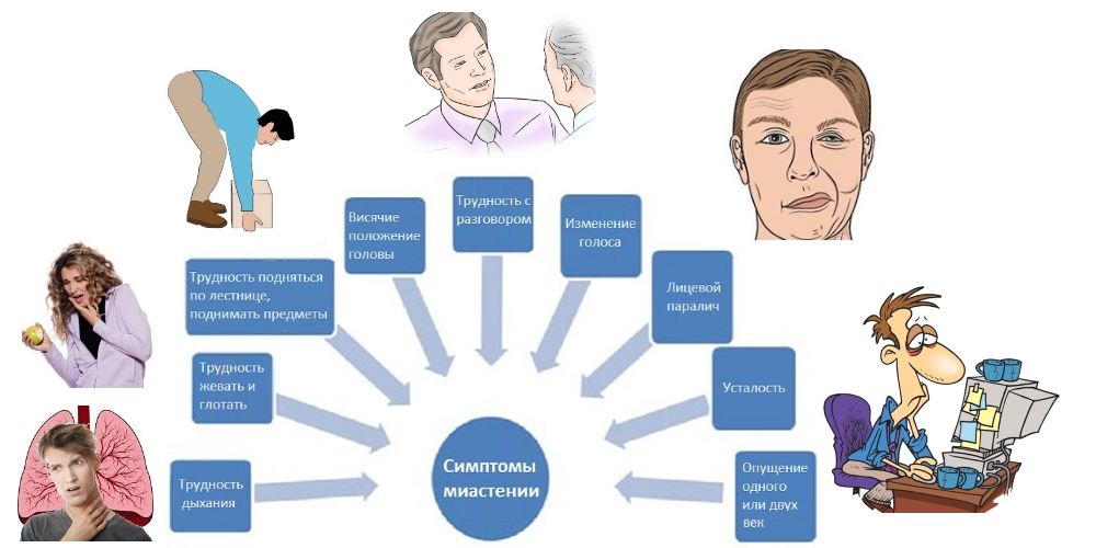 Симптомы миастении Симптомы миастении