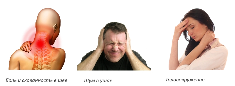 Симптомы вертеброгенной цервикалгии Симптомы вертеброгенной цервикалгии
