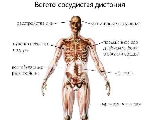 Симптомы ВСД Симптомы ВСД