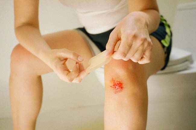 Синовит на фоне травмы Синовит на фоне травмы