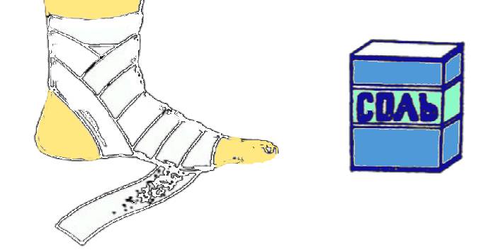 Солевая повязка на пятку Солевая повязка на пятку