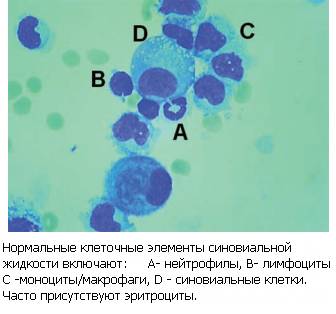 Состав синовиальной жидкости Состав синовиальной жидкости