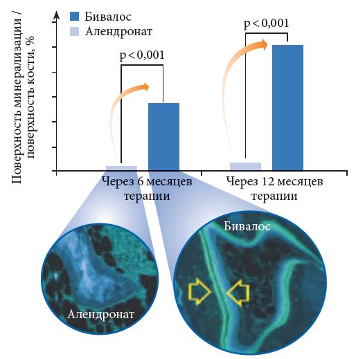 Сравнение Бивалоса и алендроната Сравнение Бивалоса и алендроната