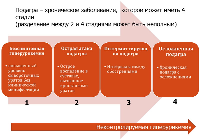 Степени подагры Степени подагры