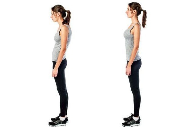 Сутулость осанки