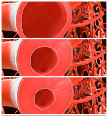 Сужение сосудов с помощью мази Сужение сосудов с помощью мази