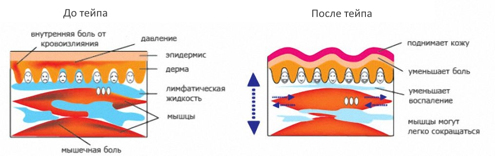 Влияние тейпа Влияние тейпа