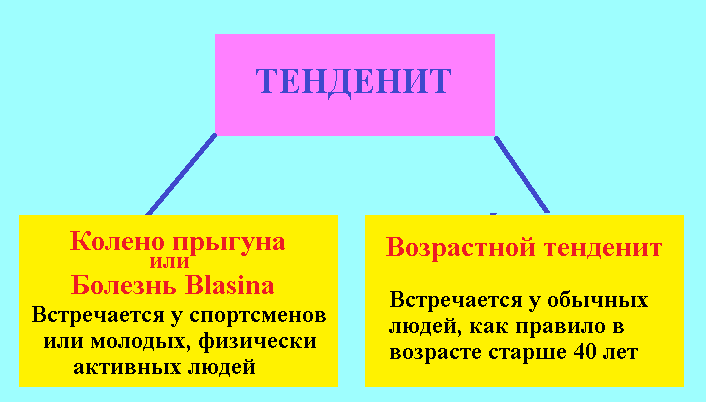 Типы тендинита