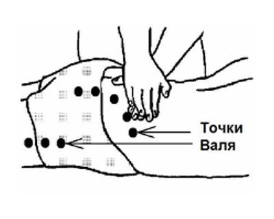 Диагностика люмбаго при помощи точек Вале Диагностика люмбаго при помощи точек Вале