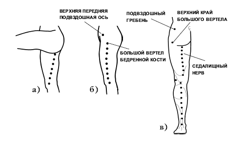 Точки для массажа ноги при защемлении Точки для массажа ноги при защемлении