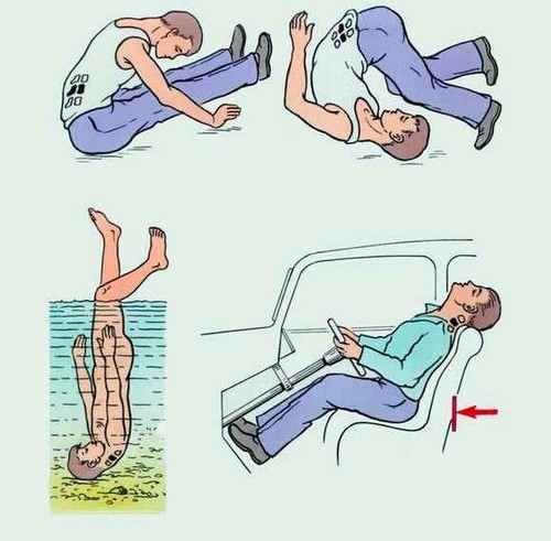 Травмирование шеи Травмирование шеи