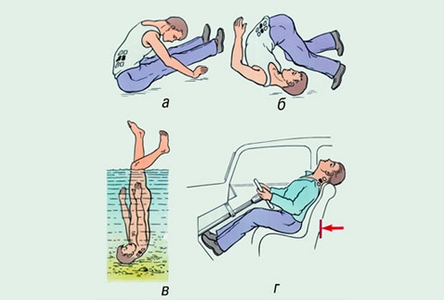 Травмирование позвоночника Травмирование позвоночника