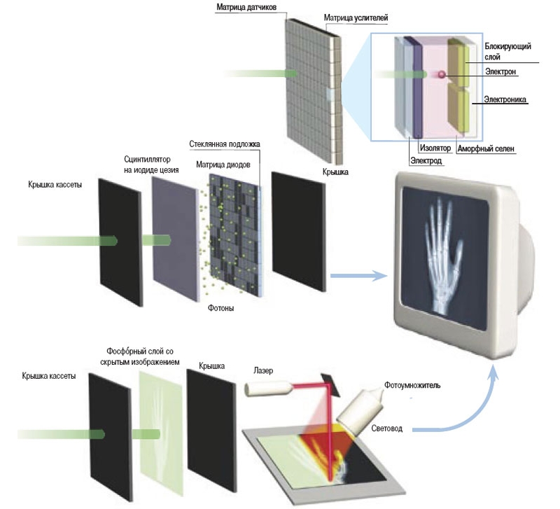 Цифровой рентген Цифровой рентген