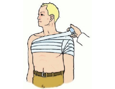 Тугая повязка на плечо