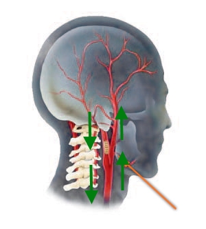 Улучшение кровообращения шеи Улучшение кровообращения шеи