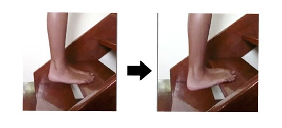 Упражнение на ступенях при пяточной шпоре Упражнение на ступенях при пяточной шпоре