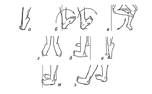 Упражнения после перелома костей стопы Упражнения после перелома костей стопы