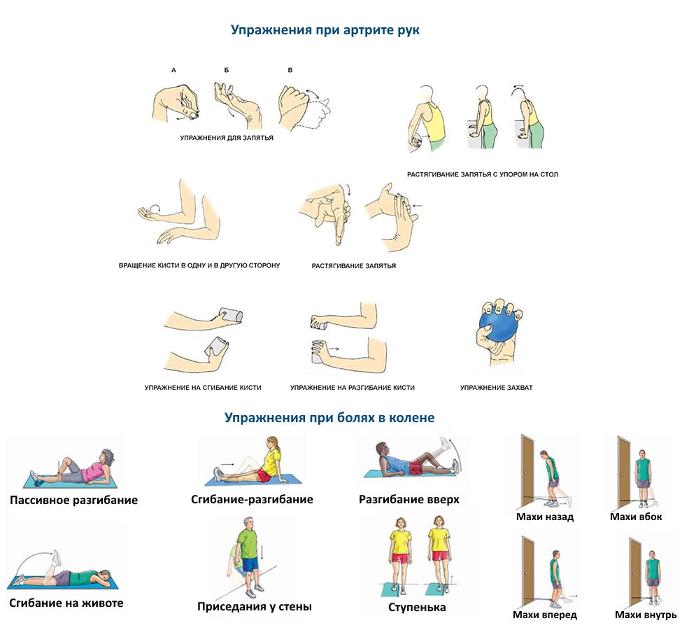 Упражнения при артрите коленей и рук Упражнения при артрите коленей и рук