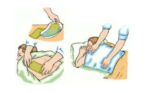 Установка горчичников при остеохондрозе Установка горчичников при остеохондрозе