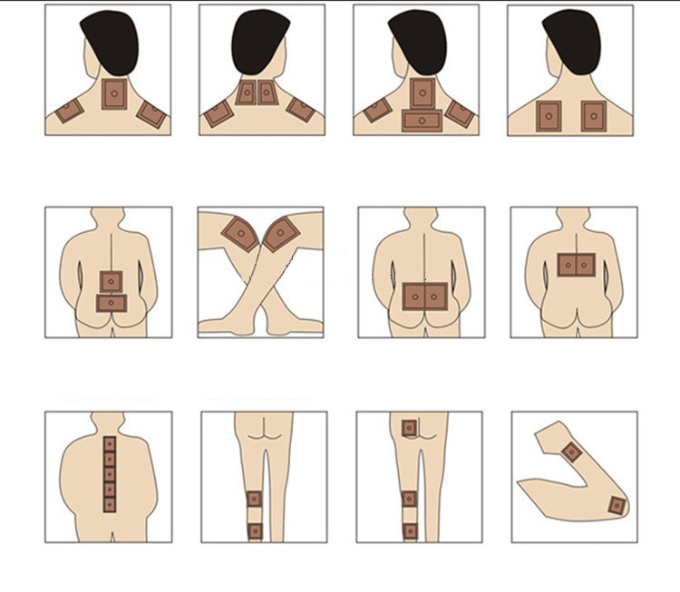 Варианты установки пластыря при остеохондрозе Варианты установки пластыря при остеохондрозе