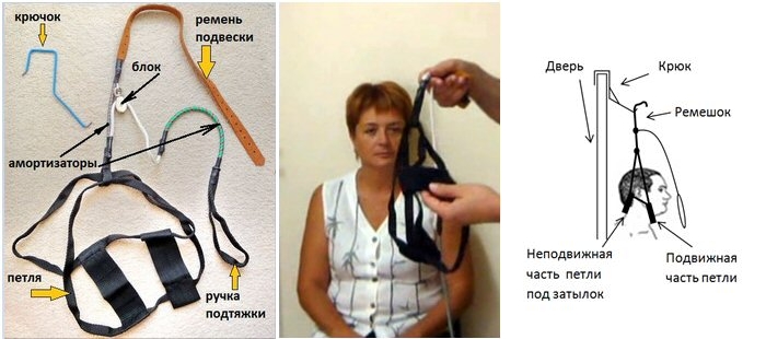 Устройство петли Глиссона Устройство петли Глиссона