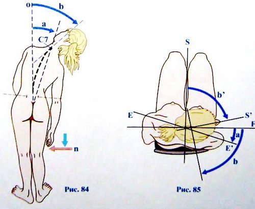 Увеличение подвижности суставов Увеличение подвижности суставов