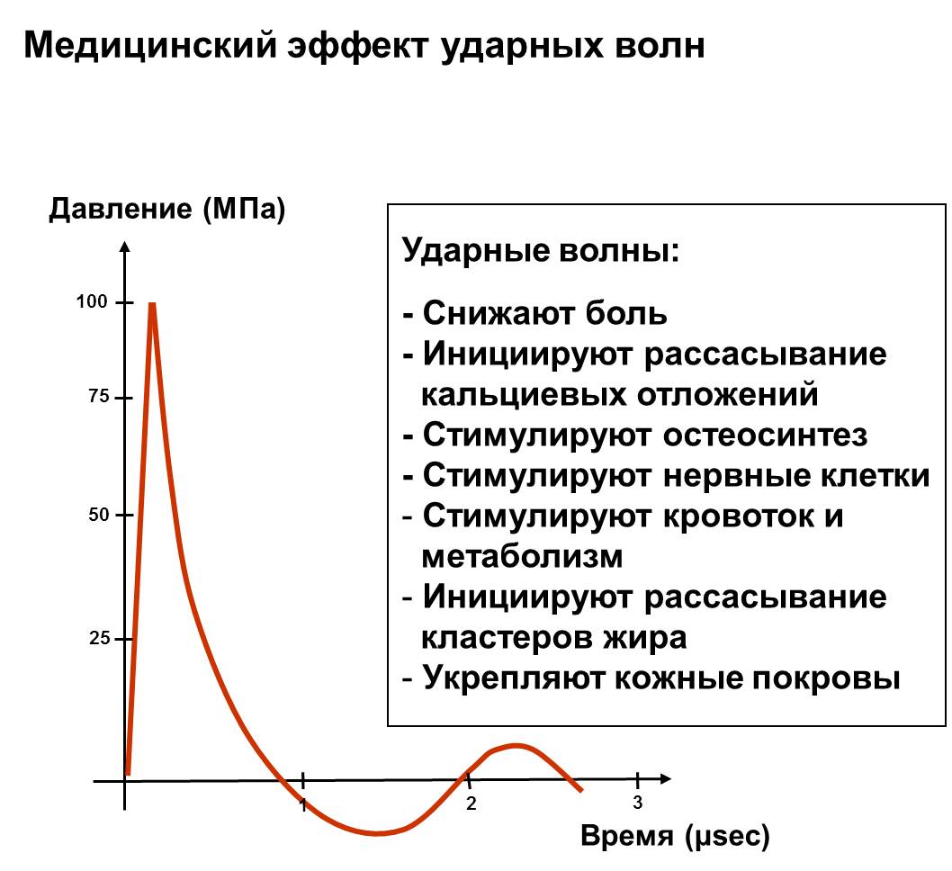 Медицинский эффект от УВТ Медицинский эффект от УВТ