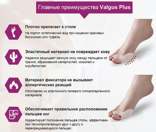 Преимущества фиксатора Valgus plus Преимущества фиксатора Valgus plus