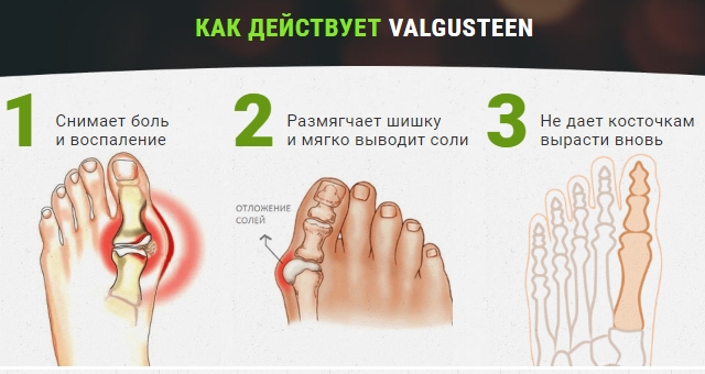 Действие Вальгустина Действие Вальгустина