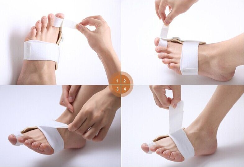 Надевание шины Валюфикс Надевание шины Валюфикс