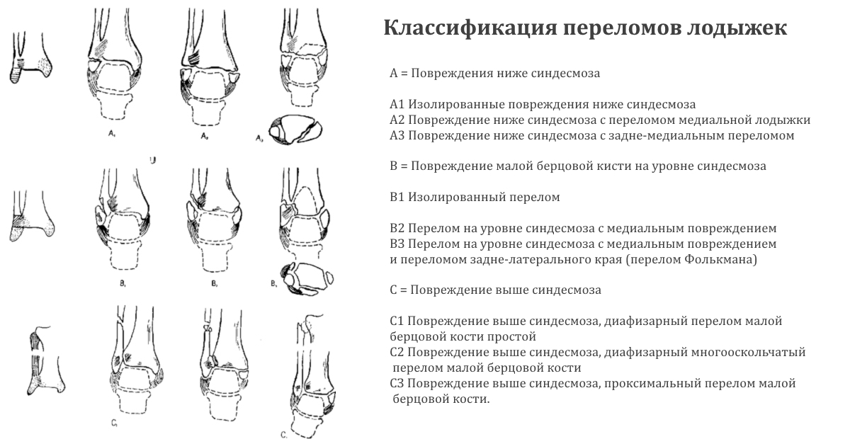 Классификация переломов Классификация переломов