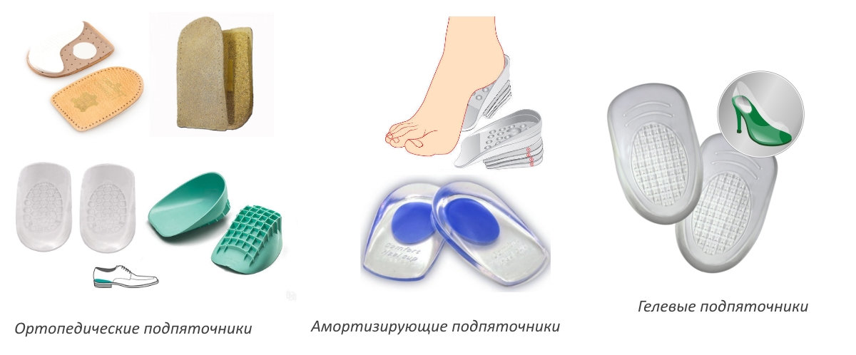 Виды подпяточников Виды подпяточников