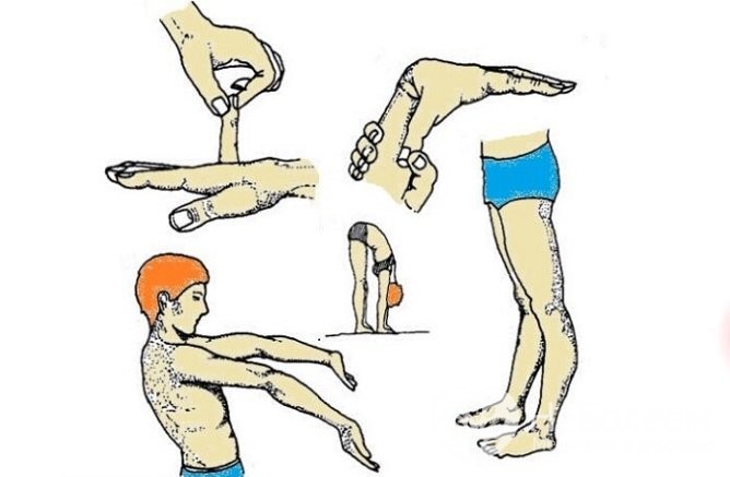 Внешние проявления дисплазии соединительной ткани Внешние проявления дисплазии соединительной ткани