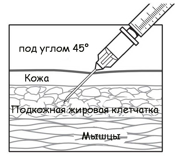 Внутрикожное введение препарата Внутрикожное введение препарата