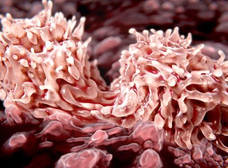 Восстановление хрящевой ткани Восстановление хрящевой ткани