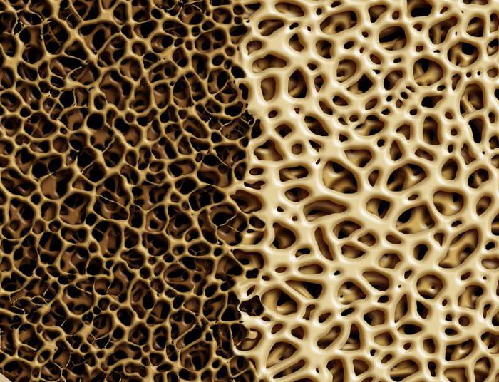 Восстановление костной ткани