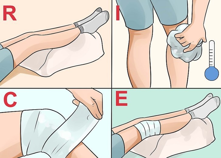 Восстановление после оперативного лечения кисты Бейкера Восстановление после оперативного лечения кисты Бейкера